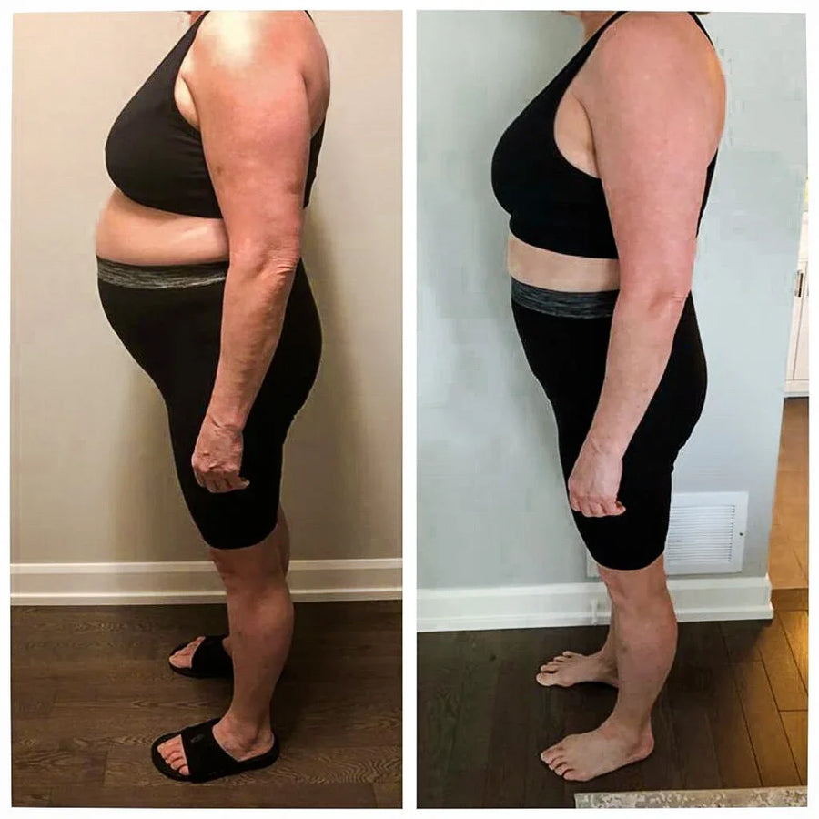 Transformation photo